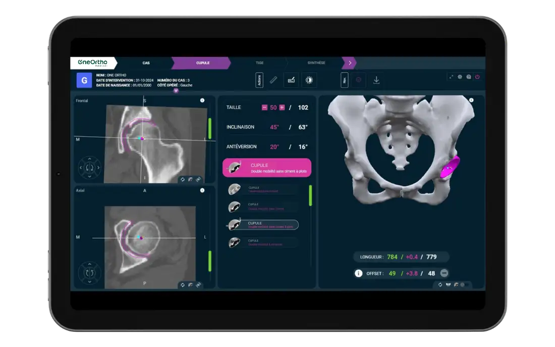 Votre bibliothèque d’implants intégrée