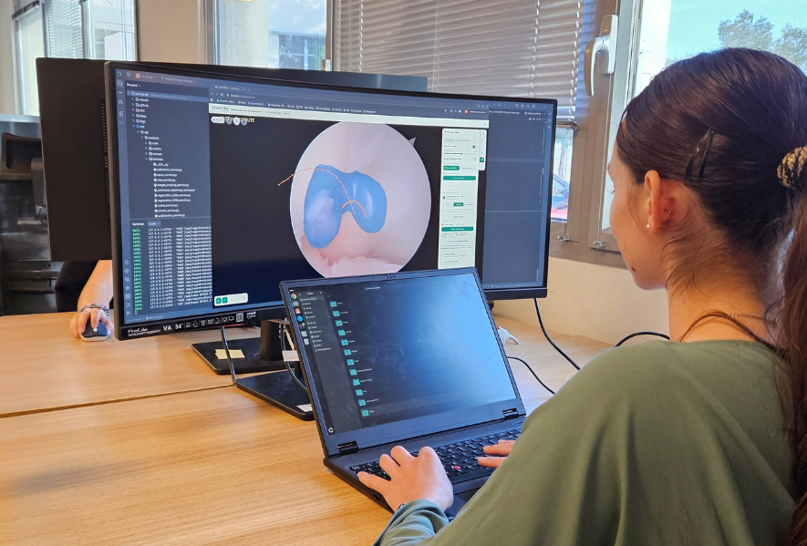Ingénieure OneOrtho travaillant sur une planification 3D du genou