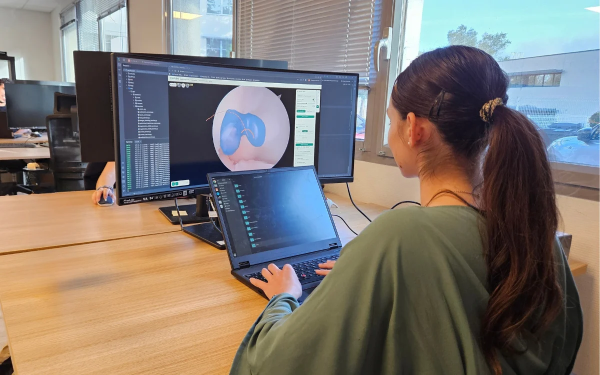 OneOrtho engineer working on a 3D knee plan